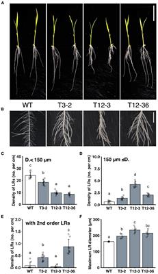 Auxin Distribution in Lateral Root Primordium Development Affects the Size and Lateral Root Diameter of Rice